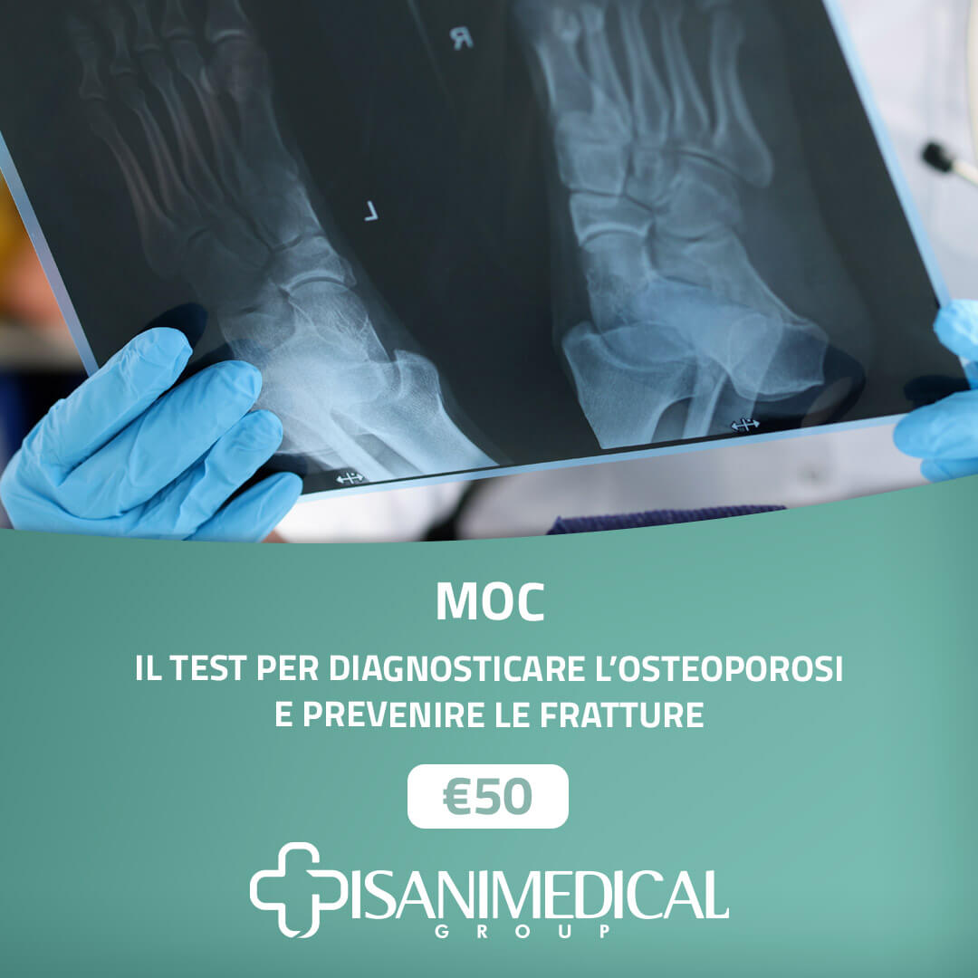 Pisano Medical Group | MOC - Il test per diagnosticare l’osteoporosi e prevenire le fratture